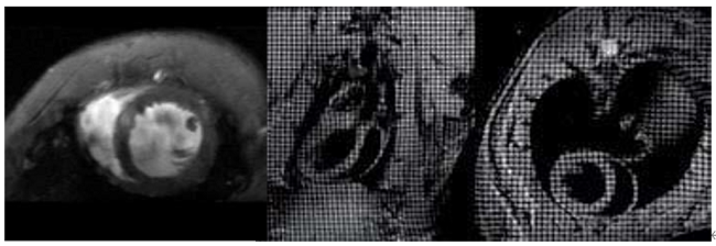 心臟成像 - 小.png 心臟成像 - 小.png